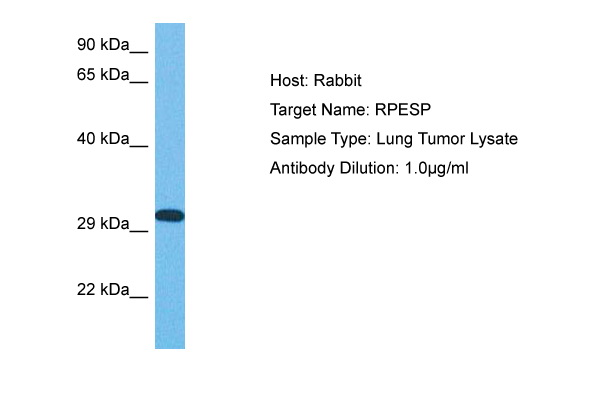 Host: Rabbit Target Name: RPESP Sample Tissue: Human Lung Tumor lysates Antibody Dilution: 1ug/ml