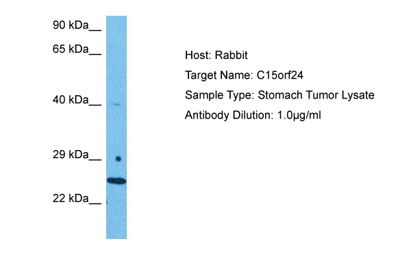 BALB/c splenocytes were double-stained with rat anti mouse IgD-FITC and rat anti-mouse CD19-R-PE Small lymphocytes were then gated and analyzed using a FACScan(TM) flow cytometer (BDIS, San Jose, CA).