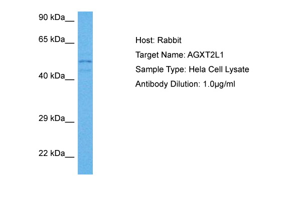 Host: Rabbit Target Name: AGXT2L1 Sample Tissue: Human HeLa Whole Cell lysates Antibody Dilution: 1ug/ml