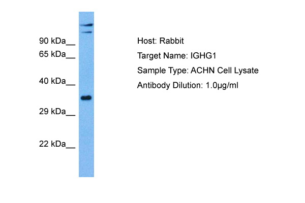 Host: Rabbit Target Name: IGHG1 Sample Tissue: Human ACHN Whole Cell lysates Antibody Dilution: 1ug/ml