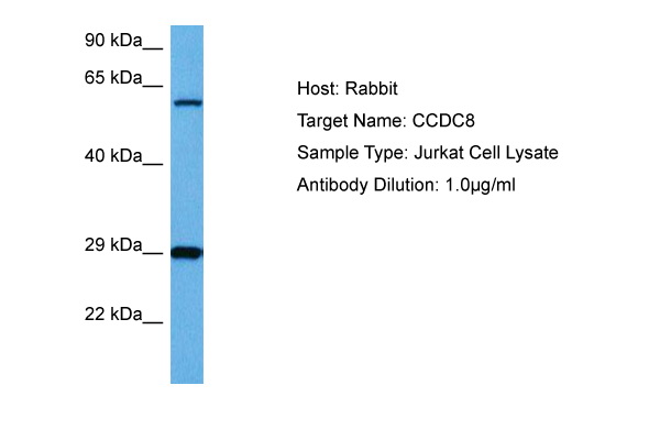 Host: Rabbit Target Name: CCDC8 Sample Tissue: Human Jurkat Whole Cell lysates Antibody Dilution: 1ug/ml