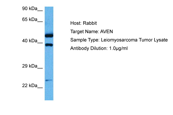 Host: Rabbit Target Name: AVEN Sample Tissue: Human Leiomyosarcoma Tumor lysates Antibody Dilution: 1ug/ml