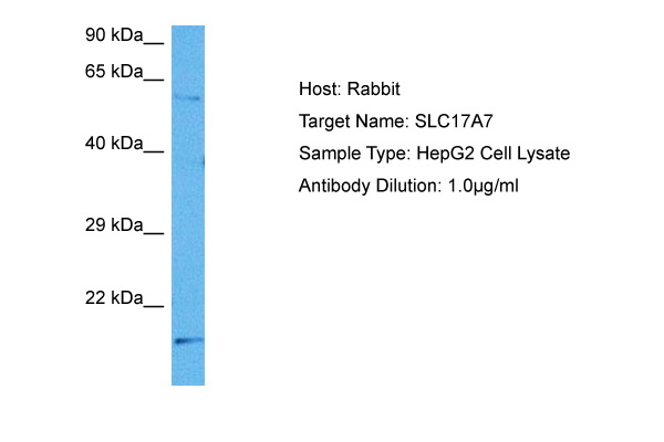 Host: Rabbit Target Name: SLC17A7 Sample Tissue: Human HepG2 Whole Cell lysates Antibody Dilution: 1ug/ml