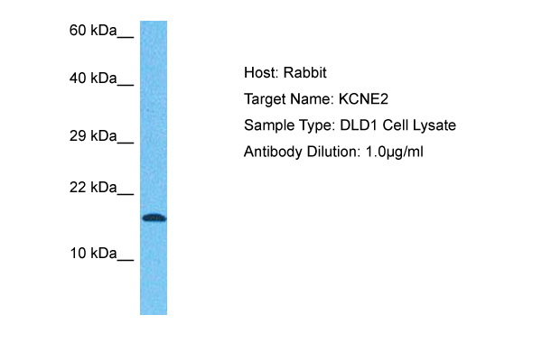 Host: Rabbit Target Name: KCNE2 Sample Tissue: Human DLD1 Whole Cell lysates Antibody Dilution: 1ug/ml