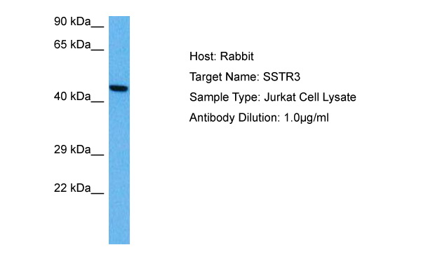Host: Rabbit Target Name: SSTR3 Sample Tissue: Human Jurkat Whole Cell lysates Antibody Dilution: 1ug/ml