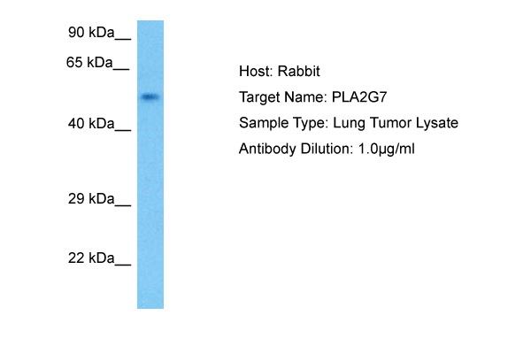 Host: Rabbit Target Name: PLA2G7 Sample Tissue: Human Lung Tumor lysates Antibody Dilution: 1ug/ml