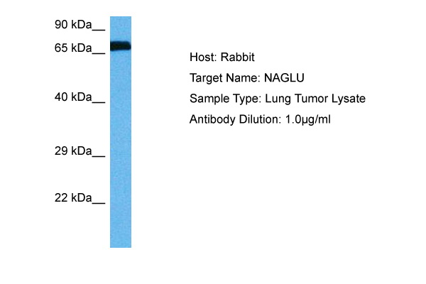 Host: Rabbit Target Name: NAGLU Sample Tissue: Human Lung Tumor lysates Antibody Dilution: 1ug/ml