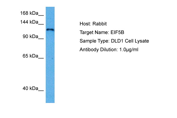 Host: Rabbit Target Name: EIF5B Sample Tissue: Human DLD1 Whole Cell lysates Antibody Dilution: 1ug/ml