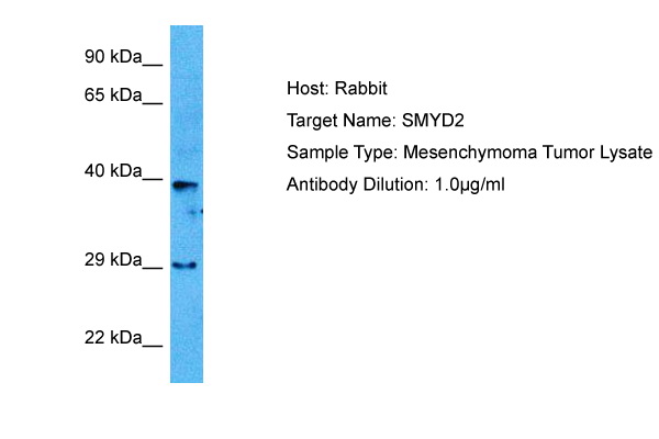 Host: Rabbit Target Name: SMYD2 Sample Tissue: Human Mesenchymoma Tumor lysates Antibody Dilution: 1ug/ml