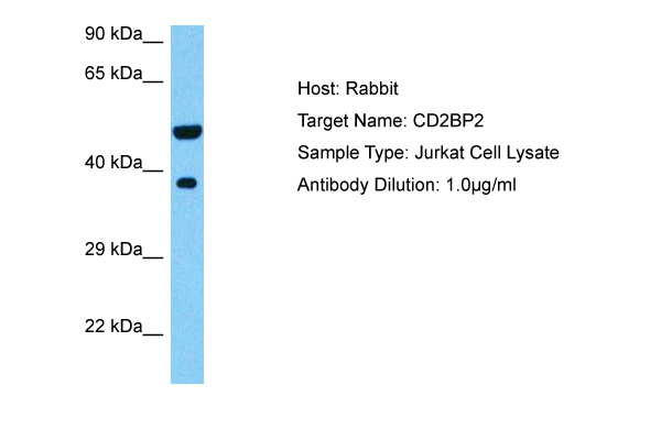 Host: Rabbit Target Name: CD2BP2 Sample Tissue: Human Jurkat Whole Cell lysates Antibody Dilution: 1ug/ml
