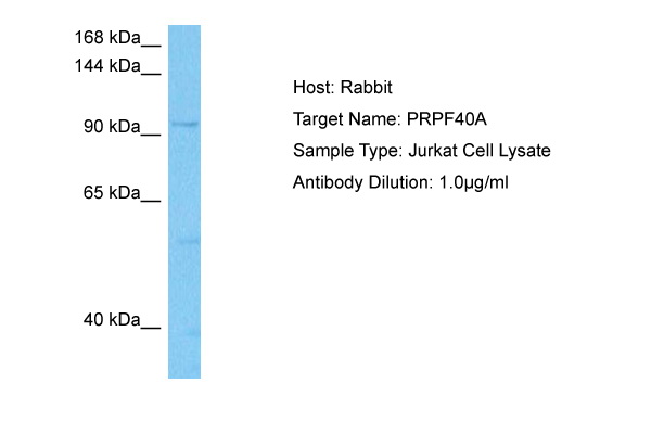Host: Rabbit Target Name: PRPF40A Sample Tissue: Human Jurkat Whole Cell lysates Antibody Dilution: 1ug/ml