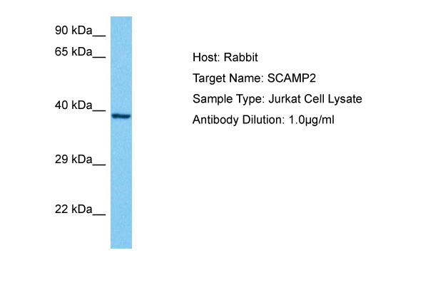 Host: Rabbit Target Name: SCAMP2 Sample Tissue: Human Jurkat Whole Cell lysates Antibody Dilution: 1ug/ml