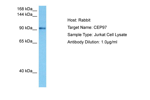 Host: Rabbit Target Name: CEP97 Sample Tissue: Human Jurkat Whole Cell lysates Antibody Dilution: 1ug/ml