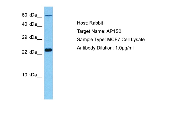 Immunofluorescent Staining: Chicken peripheral blood mononuclear cells were double stained with Mouse anti-Chicken CD3-PE and Mouse anti-Chicken CD8a-FITC (AM08116FC-N). Small lymphocytes were then gated and analyzed on a FACScan (TM) flow cytometer (BDIS,