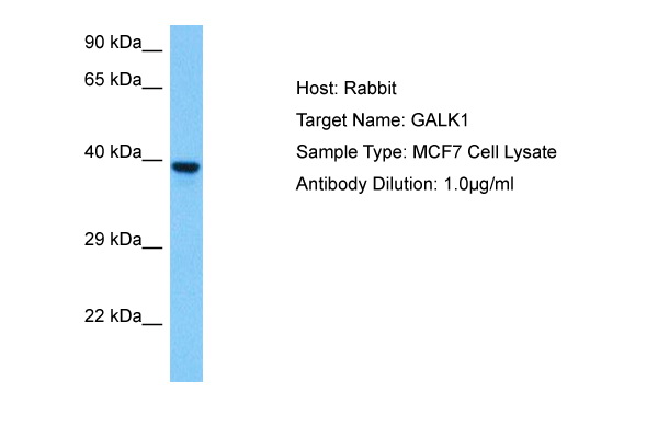 Host: Rabbit Target Name: GALK1 Sample Tissue: Human MCF7 Whole Cell lysates Antibody Dilution: 1ug/ml