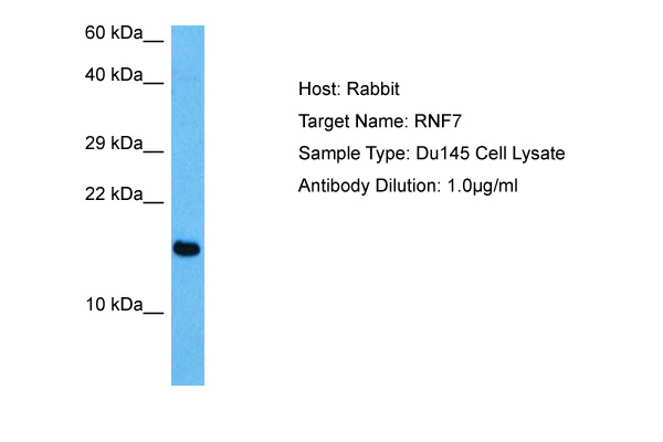 Immunofluorescent Staining: Chicken PBMC were double stained with Mouse anti-Chicken CD4-FITC and mouse anti-chicken CD8-R-PE. Small lymphocytes were then gated and analyzed on a FACScan (TM) flow cytometer (BDIS, San Jose, CA). Amount Used: &lt; / = 0.2 g/