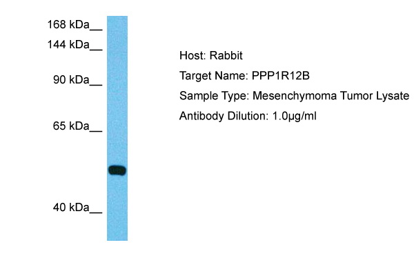 Host: Rabbit Target Name: PPP1R12B Sample Tissue: Human Mesenchymoma Tumor lysates Antibody Dilution: 1ug/ml