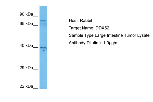Host: Rabbit Target Name: DDX52 Sample Tissue: Human Large Intestine Tumor lysates Antibody Dilution: 1ug/ml