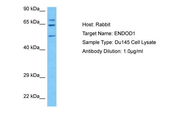 Host: Rabbit Target Name: ENDOD1 Sample Tissue: Human Du145 Whole Cell lysates Antibody Dilution: 1ug/ml