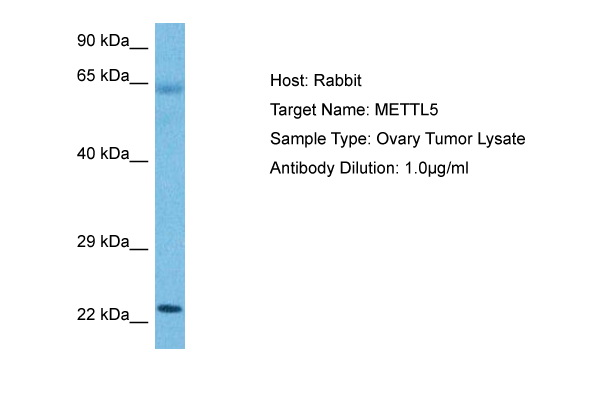Host: Rabbit Target Name: METTL5 Sample Tissue: Human Ovary Tumor lysates Antibody Dilution: 1ug/ml