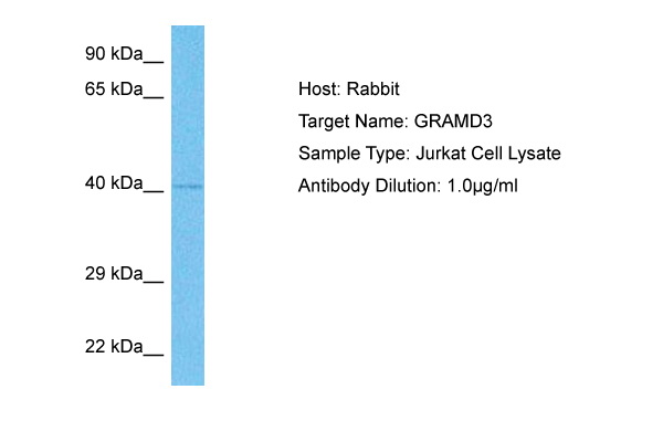 Host: Rabbit Target Name: GRAMD3 Sample Tissue: Human Jurkat Whole Cell lysates Antibody Dilution: 1ug/ml
