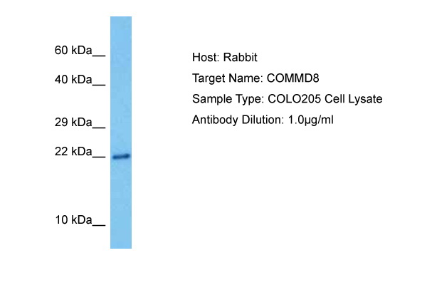 Host: Rabbit Target Name: COMMD8 Sample Tissue: Human COLO205 Whole Cell lysates Antibody Dilution: 1ug/ml