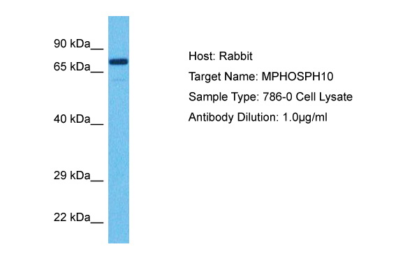 Host: Rabbit Target Name: MPHOSPH10 Sample Tissue: Human 786-0 Whole Cell lysates Antibody Dilution: 1ug/ml