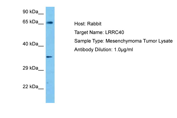 Host: Rabbit Target Name: LRRC40 Sample Tissue: Human Mesenchymoma Tumor lysates Antibody Dilution: 1ug/ml