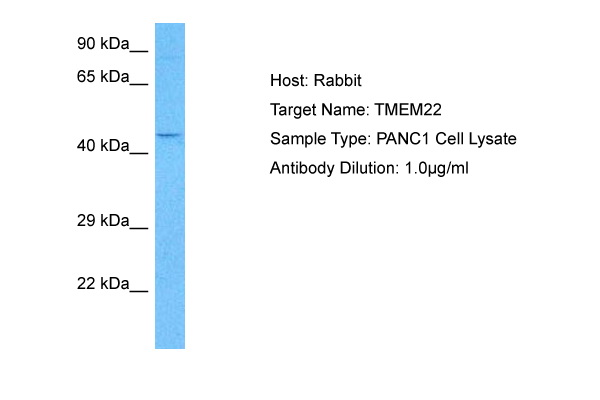 Host: Rabbit Target Name: TMEM22 Sample Tissue: Human PANC1 Whole Cell lysates Antibody Dilution: 1ug/ml