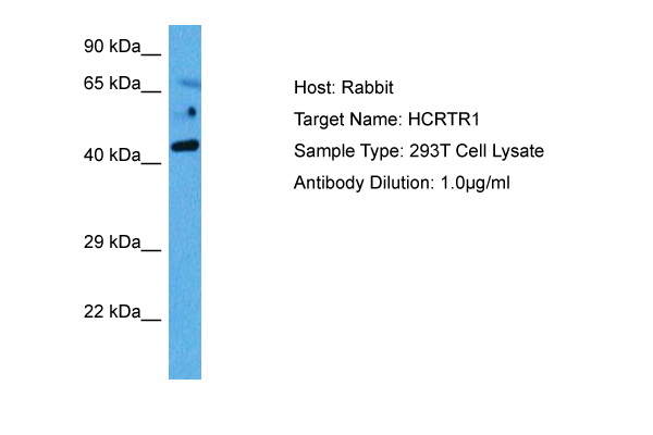 Host: Rabbit Target Name: HCRTR1 Sample Tissue: Human 293T Whole Cell lysates Antibody Dilution: 1ug/ml