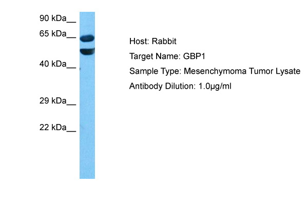 Lung: Formalin-Fixed Paraffin-Embedded (FFPE)