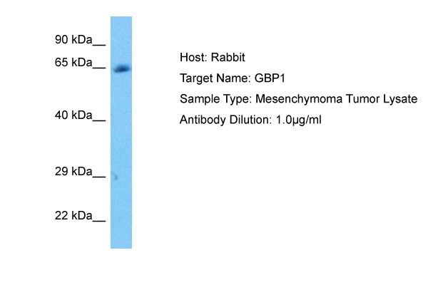 Figure 1. Affinity purified Antibody to detect FLAG (TM) conj ugated proteins detects both C terminal linked and N terminal linked FLAG (TM) tagged recombinant proteins by western blot