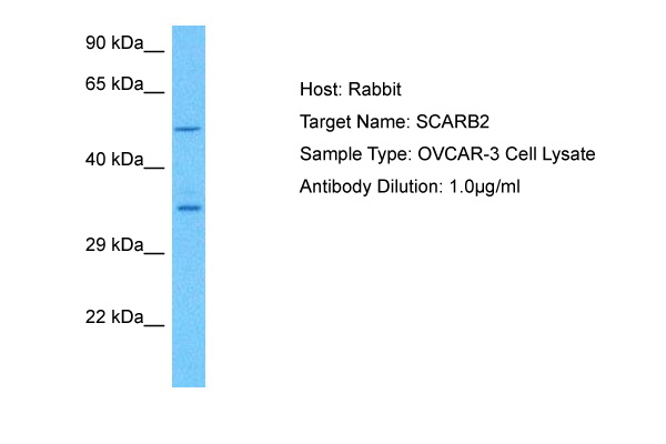 Host: Rabbit Target Name: SCARB2 Sample Tissue: Human OVCAR-3 Whole Cell lysates Antibody Dilution: 1ug/ml