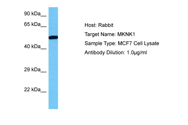 Host: Rabbit Target Name: MKNK1 Sample Tissue: Human MCF7 Whole Cell lysates Antibody Dilution: 1ug/ml