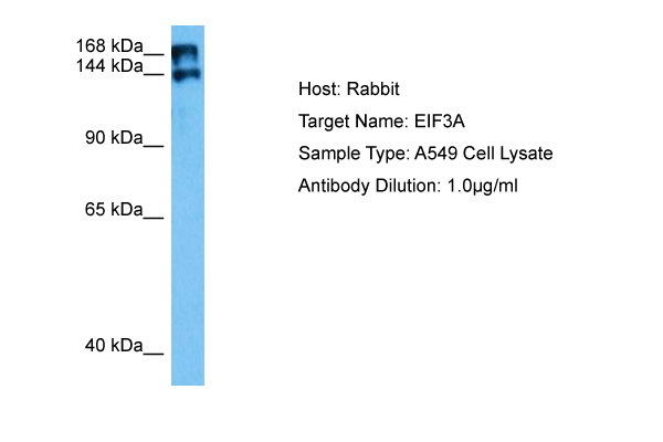 Host: Rabbit Target Name: EIF3A Sample Tissue: Human A549 Whole Cell lysates Antibody Dilution: 1ug/ml