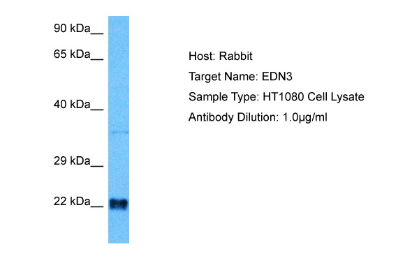 Western blot analysis: Cell lysates of Mouse brain (30 ug) were resolved by SDS-PAGE, transferred to PVDF membrane and probed with anti-Human PSPH antibody (1/1000). Proteins were visualized using a goat anti-mouse secondary antibody conj ugated to HRP and an ECL detection system.