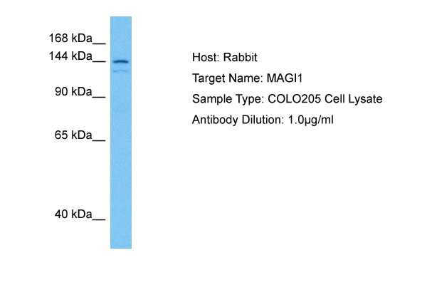Host: Rabbit Target Name: MAGI1 Sample Tissue: Human COLO205 Whole Cell lysates Antibody Dilution: 1ug/ml