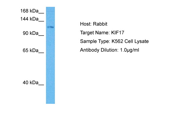 Host: Rabbit Target Name: KIF17 Sample Tissue: Human K562 Whole Cell lysates Antibody Dilution: 1ug/ml