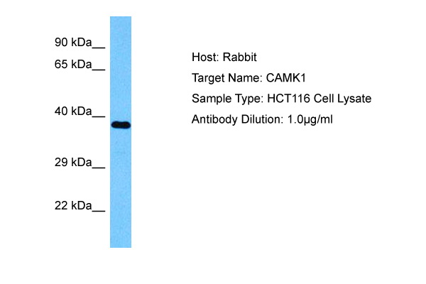 Host: Rabbit Target Name: CAMK1 Sample Tissue: Human HCT116 Whole Cell lysates Antibody Dilution: 1ug/ml