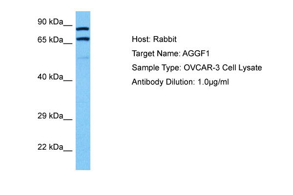 Western blot using GAPDH Antibody Clone H8