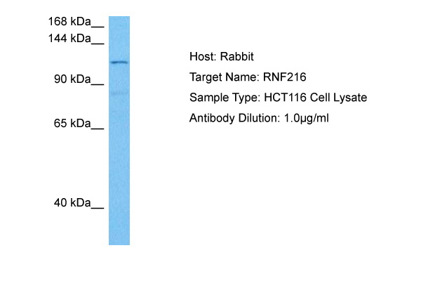 Host: Rabbit Target Name: RNF216 Sample Tissue: Human HCT116 Whole Cell lysates Antibody Dilution: 1ug/ml