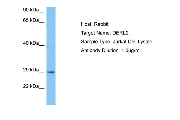 Host: Rabbit Target Name: DERL2 Sample Tissue: Human Jurkat Whole Cell lysates Antibody Dilution: 1ug/ml