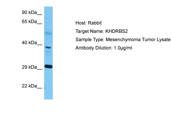 Host: Rabbit Target Name: KHDRBS2 Sample Tissue: Human Mesenchymoma Tumor lysates Antibody Dilution: 1ug/ml