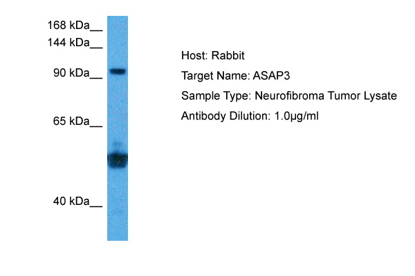 Host: Rabbit Target Name: ASAP3 Sample Tissue: Human Neurofibroma Tumor lysates Antibody Dilution: 1ug/ml