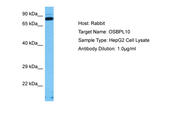 Host: Rabbit Target Name: OSBPL10 Sample Tissue: Human HepG2 Whole Cell lysates Antibody Dilution: 1ug/ml