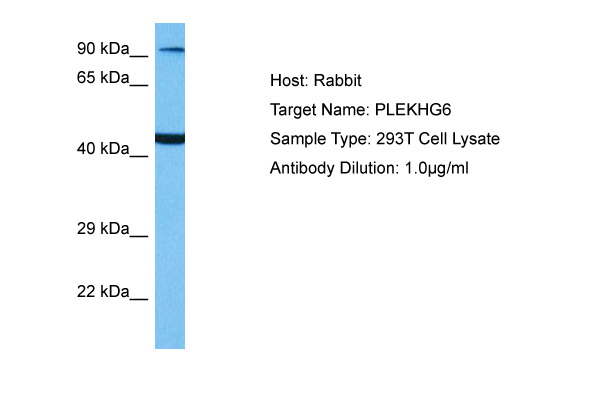 Host: Rabbit Target Name: PLEKHG6 Sample Tissue: Human 293T Whole Cell lysates Antibody Dilution: 1ug/ml