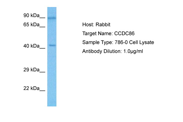 Host: Rabbit Target Name: CCDC86 Sample Tissue: Human 786-0 Whole Cell lysates Antibody Dilution: 1ug/ml