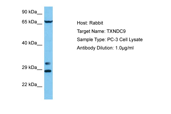 Host: Rabbit Target Name: TXNDC9 Sample Tissue: Human PC-3 Whole Cell lysates Antibody Dilution: 1ug/ml