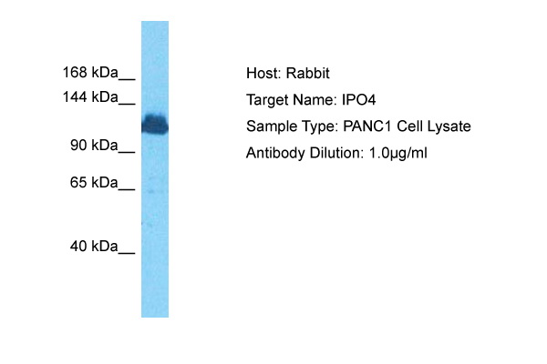 HeLa cell lysate was probed with Anti-PCNA, clone PC10 (0.01 ug/mL). Proteins were visualized using a Goat Anti-Mouse IgG (H&L) secondary antibody conj ugated to HRP and a chemiluminescence detection system. Arrow indicates (~29 kDa).