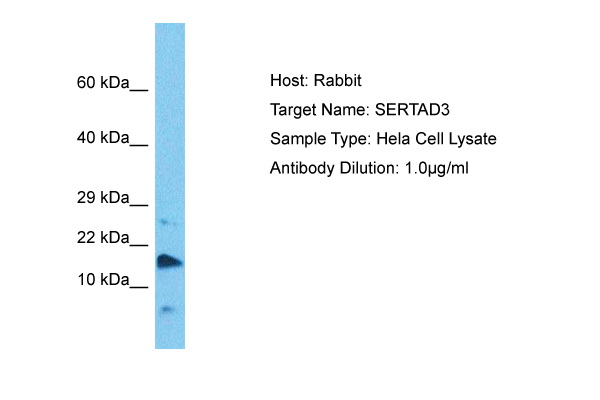Host: Rabbit Target Name: SERTAD3 Sample Tissue: Human Hela Whole Cell lysates Antibody Dilution: 1ug/ml